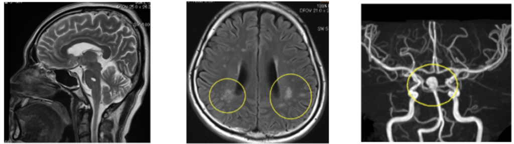 頭部MRI画像﻿